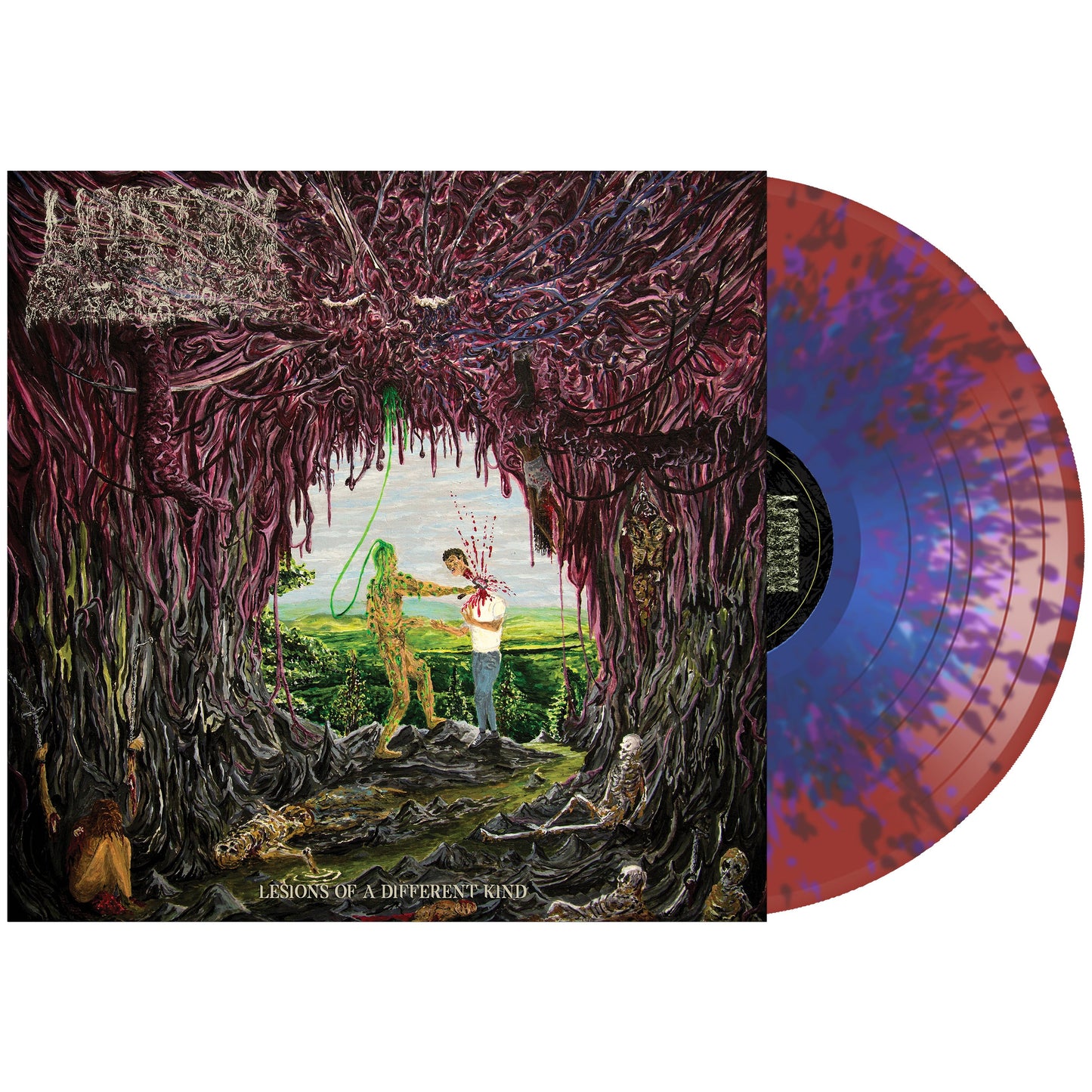 Undeath - Lesions of A Different Kind on Vinyl